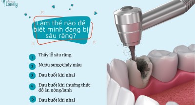 Các dấu hiệu nhận biết sâu răng