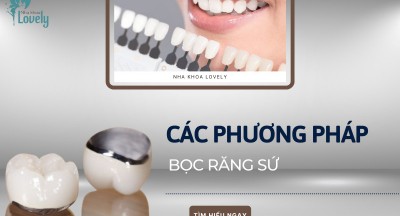 Các phương pháp bọc răng sứ - Dán sứ Veneer đừng ham rẻ