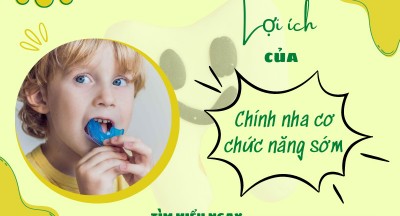 Lợi ích của việc chỉnh nha cơ chức năng sớm cho trẻ