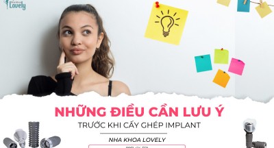 Những điều cần lưu ý trước khi cấy ghép Implant