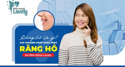 Răng hô là gì? Các phương pháp khắc phục tình trạng răng hô