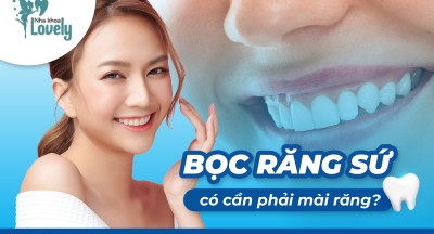 Bọc răng sứ có cần mài răng