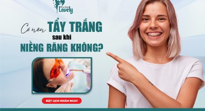 Có nên tẩy trắng sau khi niềng răng không?