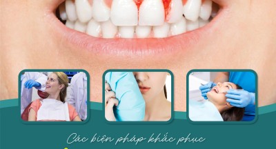 Các biện pháp khắc phục tình trạng chảy máu chân răng