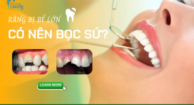 RĂNG BỊ BỂ LỚN CÓ NÊN BỌC SỨ?