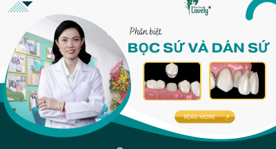 PHÂN BIỆT PHƯƠNG PHÁP BỌC SỨ VÀ DÁN SỨ