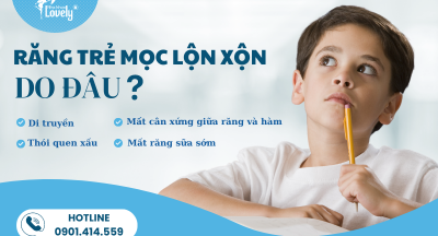 RĂNG TRẺ MỌC LỘN XỘN DO ĐÂU?