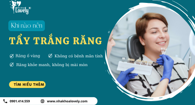 KHI NÀO NÊN TẨY TRẮNG RĂNG