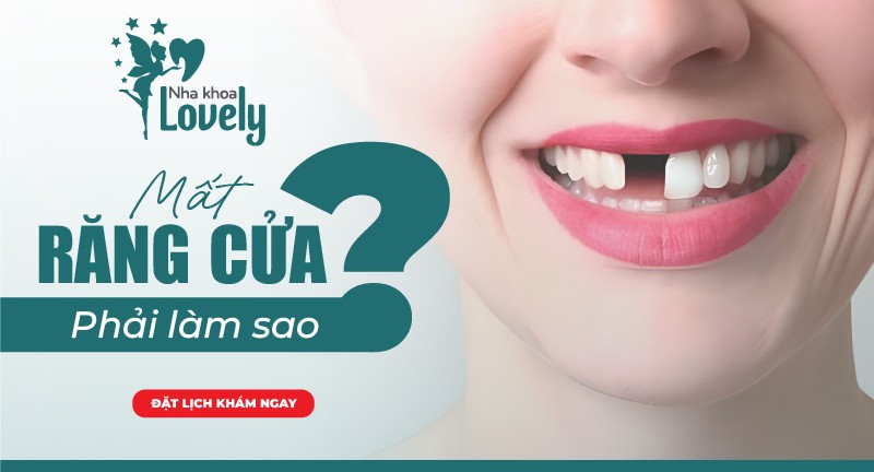 Mất răng cửa phải làm sao?