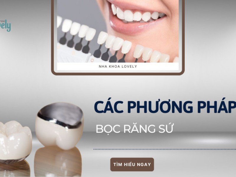 Các phương pháp bọc răng sứ - Dán sứ Veneer đừng ham rẻ