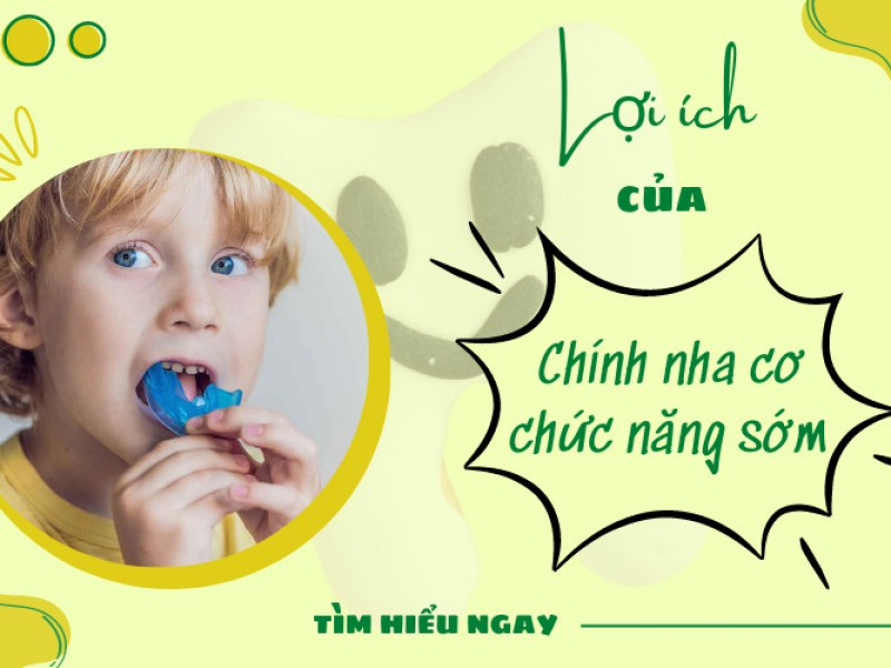 Lợi ích của việc chỉnh nha cơ chức năng sớm cho trẻ