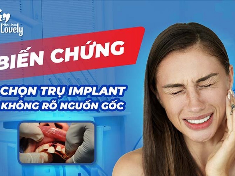 Những biến chứng khi chọn trụ Implant không rõ nguồn gốc