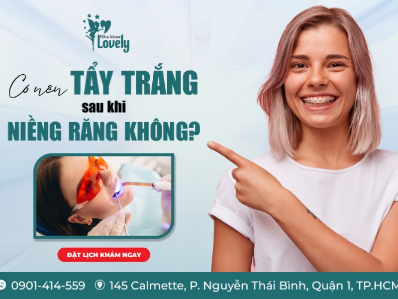 Có nên tẩy trắng sau khi niềng răng không?