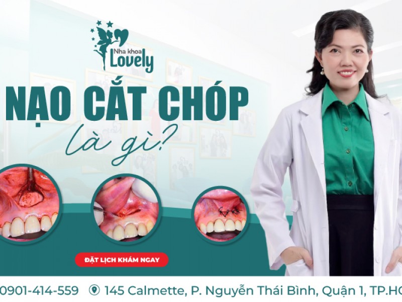 Nạo cắt chóp là gì?