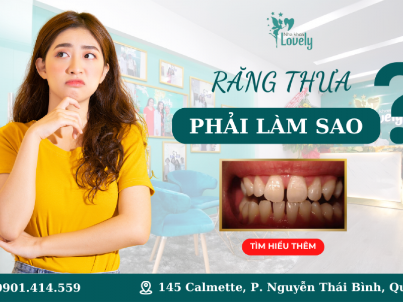 CÁCH KHẮC PHỤC TÌNH TRẠNG RĂNG THƯA