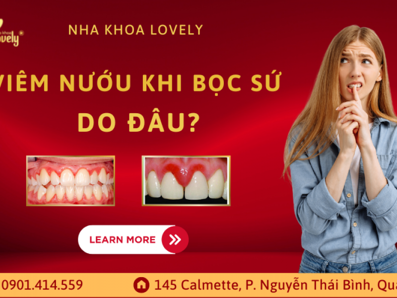 Viêm nướu khi bọc sứ do đâu?