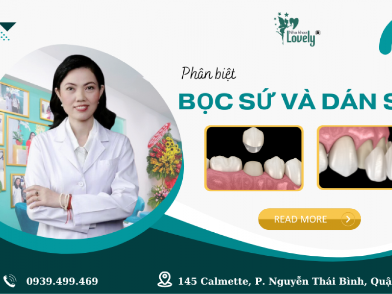 PHÂN BIỆT PHƯƠNG PHÁP BỌC SỨ VÀ DÁN SỨ