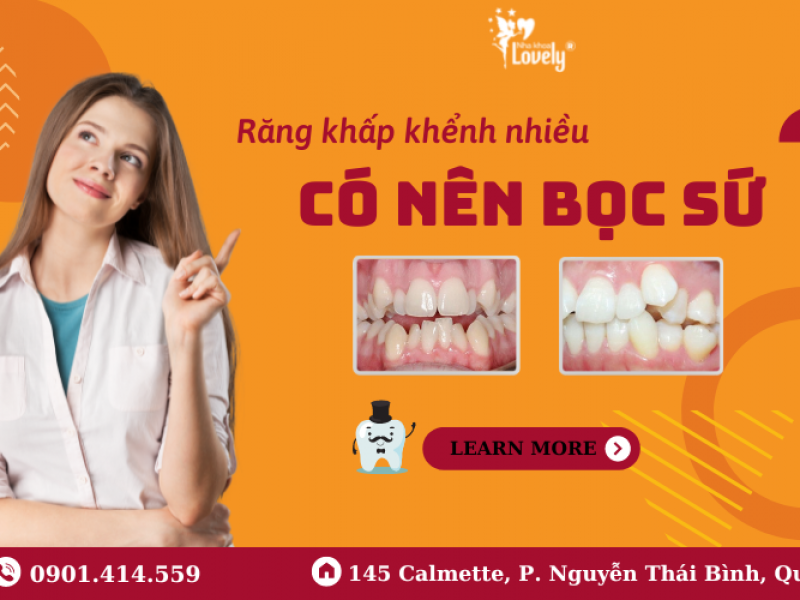 RĂNG KHẤP KHỂNH NHIỀU CÓ NÊN BỌC SỨ?