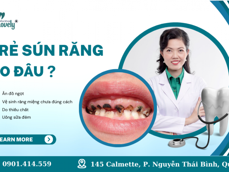 TRẺ SÚN RĂNG DO ĐÂU?