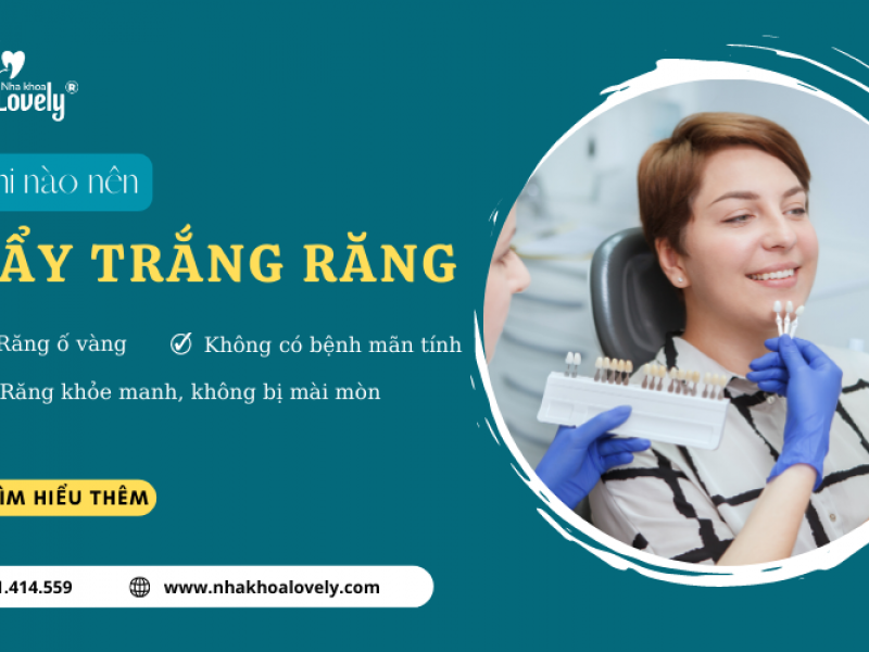 KHI NÀO NÊN TẨY TRẮNG RĂNG